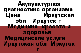 Акупунктурная диагностика организма › Цена ­ 2 100 - Иркутская обл., Иркутск г. Медицина, красота и здоровье » Медицинские услуги   . Иркутская обл.,Иркутск г.